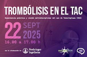 Trombólisis en el TAC: Experiencia práctica y visión multidisciplinar del uso de Tenecteplasa (M25)